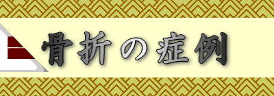 骨折の症例